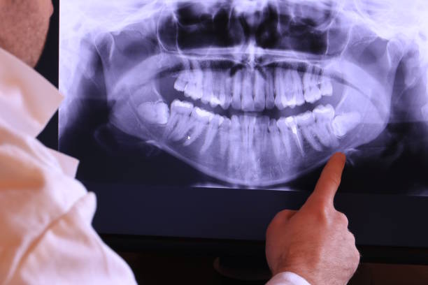 Best Broken or Cracked Tooth Emergency Dentist in Watts Mills, SC